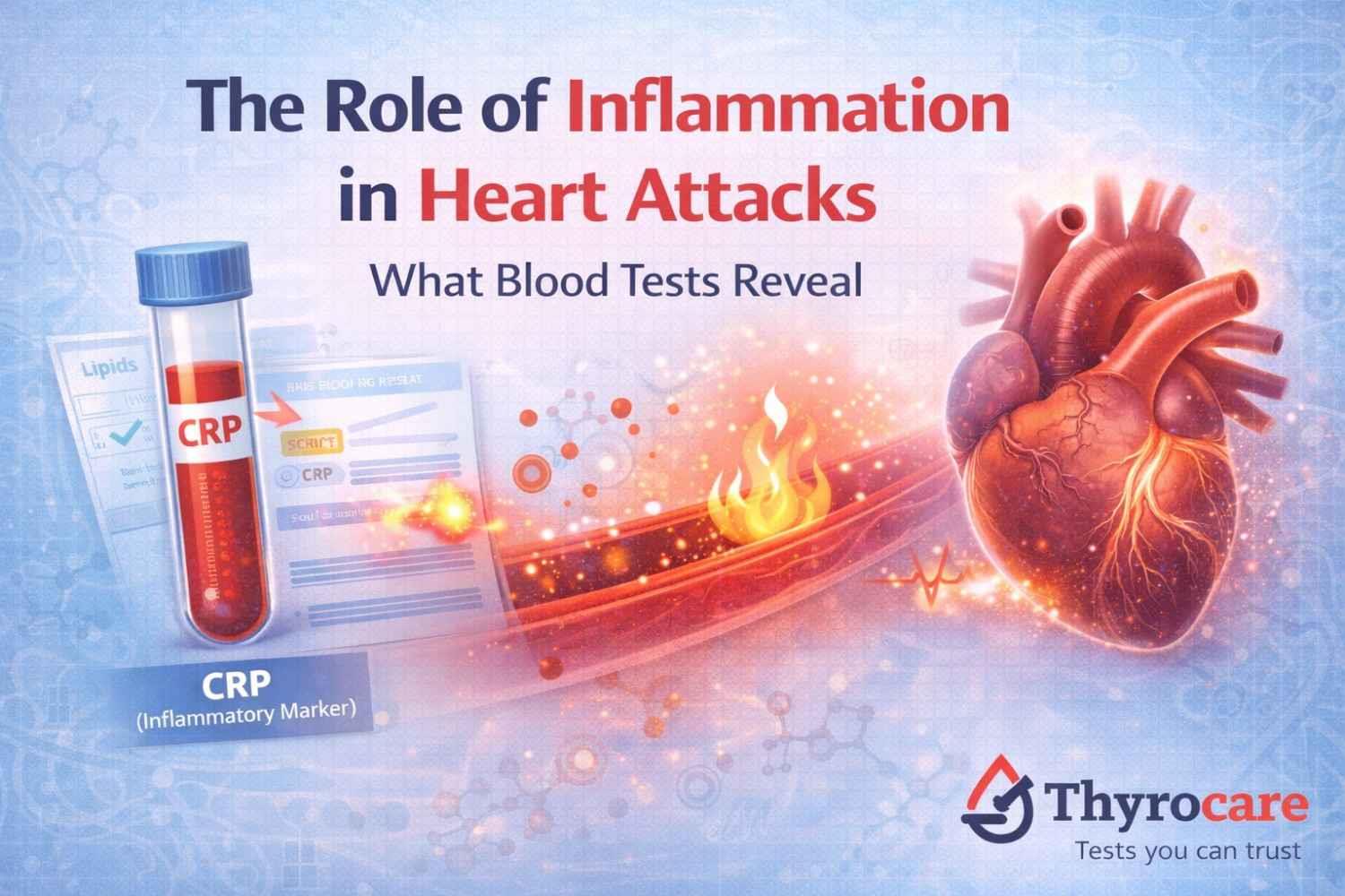 The Role of Inflammation in Heart Attacks: What Blood Tests Reveal