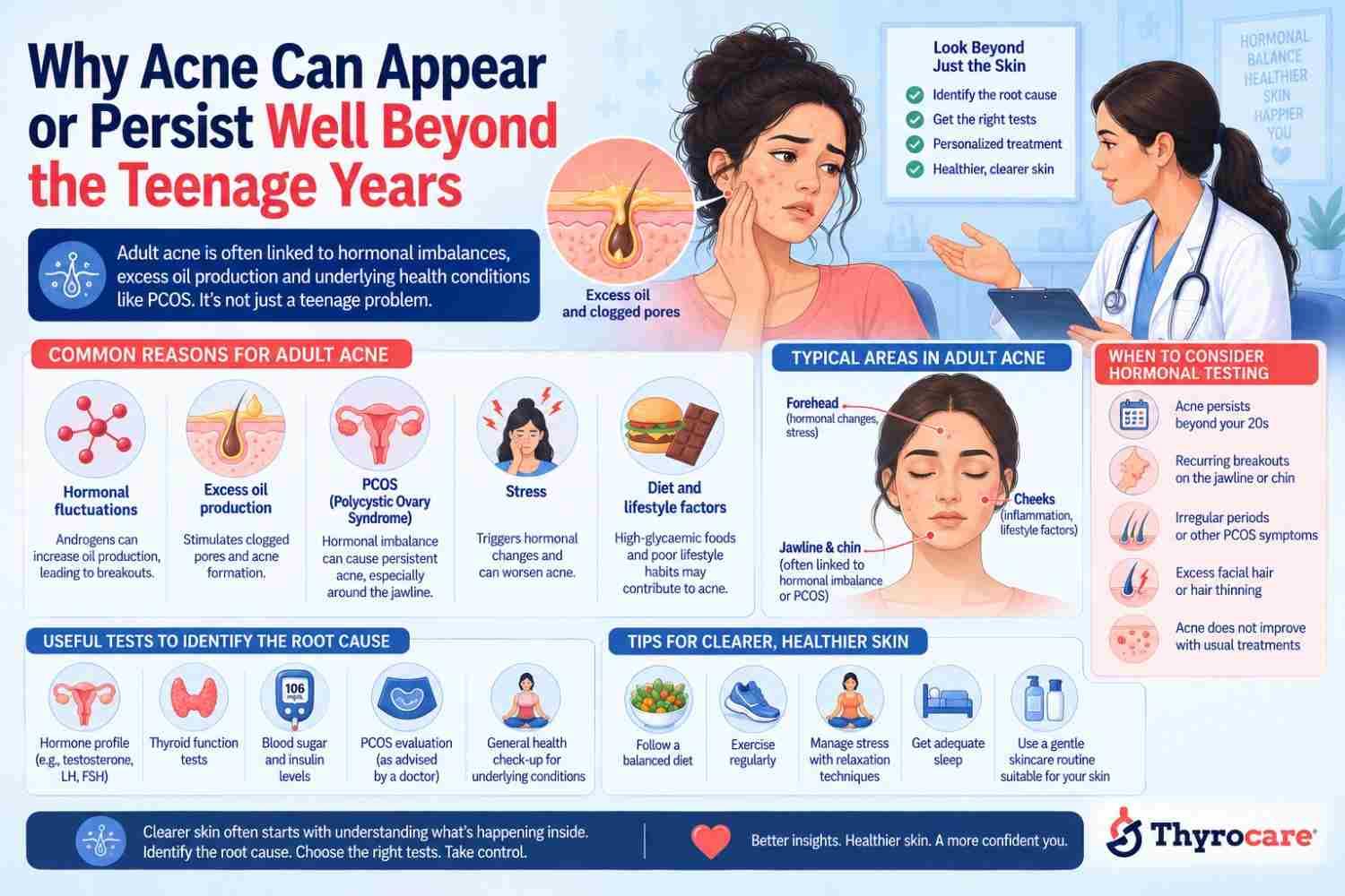 Adult Acne: When Breakouts May Be Linked to Hormonal Changes